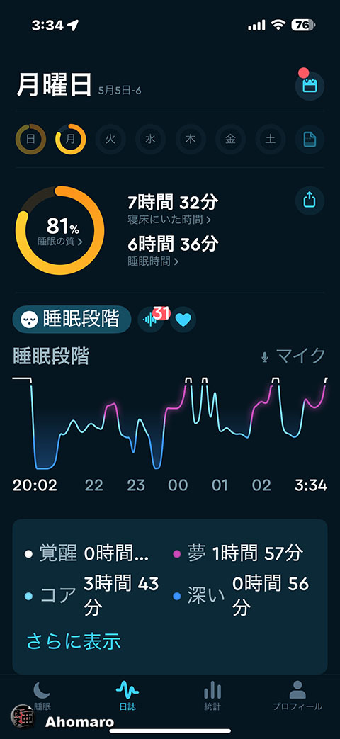 ʐ^00