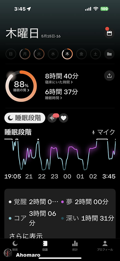 ʐ^00