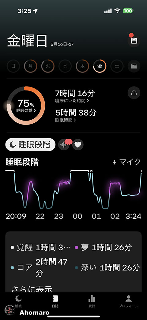 ʐ^00