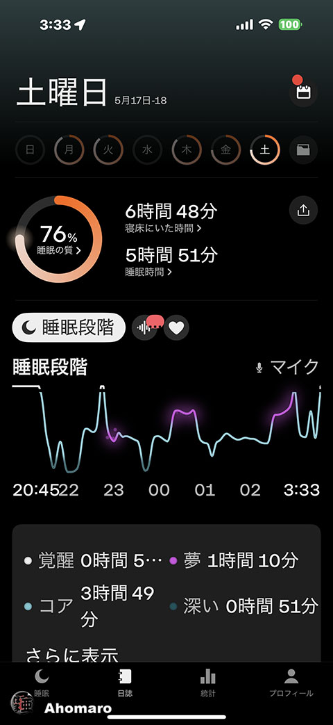 ʐ^00