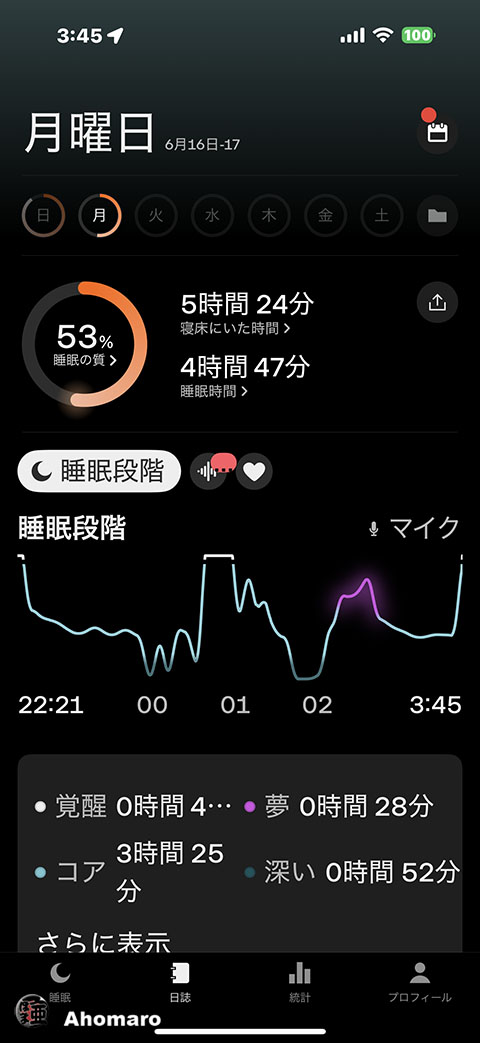 ʐ^00