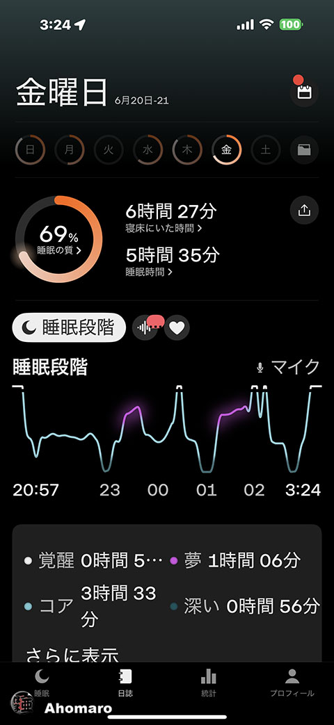ʐ^00