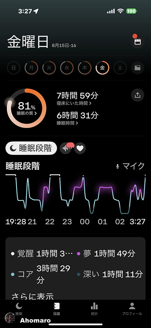 ʐ^00