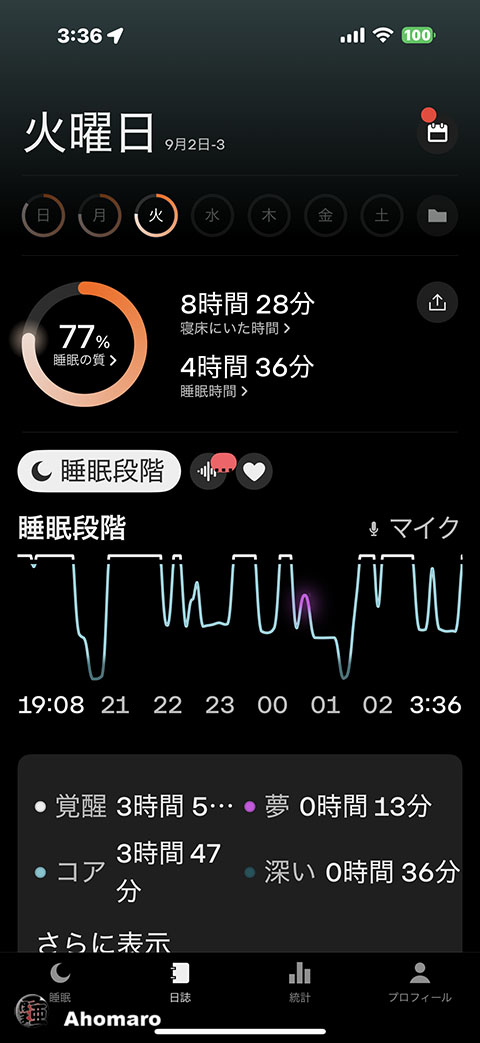 ʐ^00