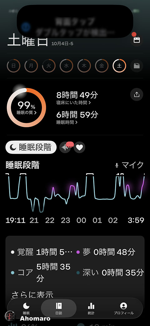 ʐ^00